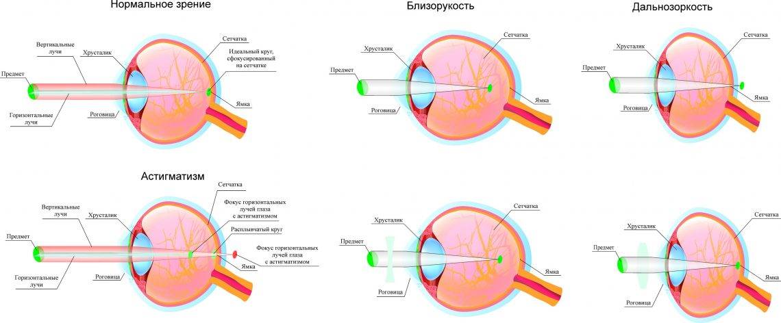 Основные сведения о рефракции глаза
