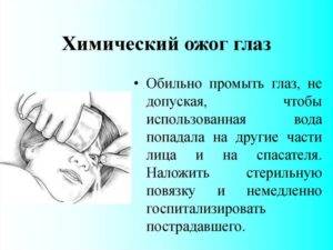 Первая помощь при травме глаза. чего категорически нельзя делать при травме глаза - sammedic.ru