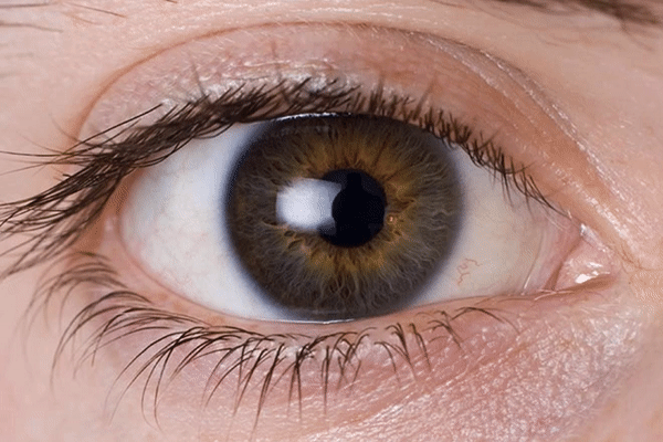 Почему дергается веко глаза: симптомы, причины и лечение