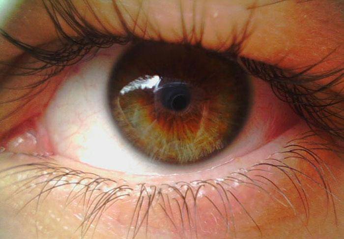 Ангиопатия сетчатки глаза у ребёнка: симптомы, лечение oculistic.ru
ангиопатия сетчатки глаза у ребёнка: симптомы, лечение