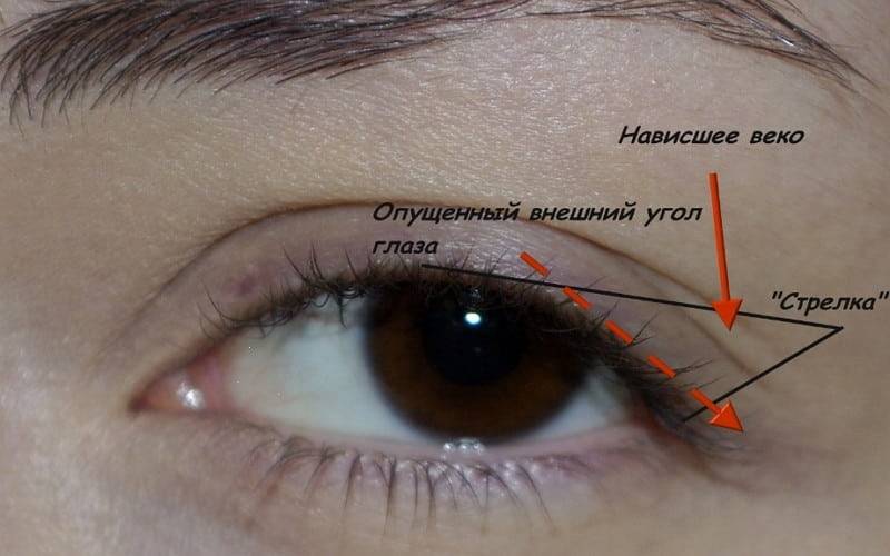 Покраснел угол глаза - покраснела кожа наружного угла глаза - вопрос офтальмологу - 03 онлайн