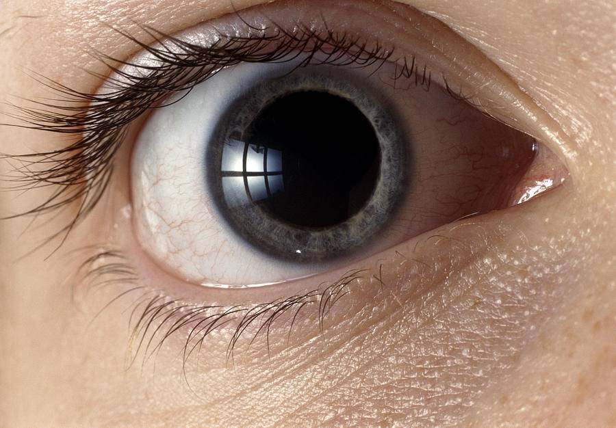 Посмотри в глаза. 10 вещей, которые глаза говорят о вашем здоровье