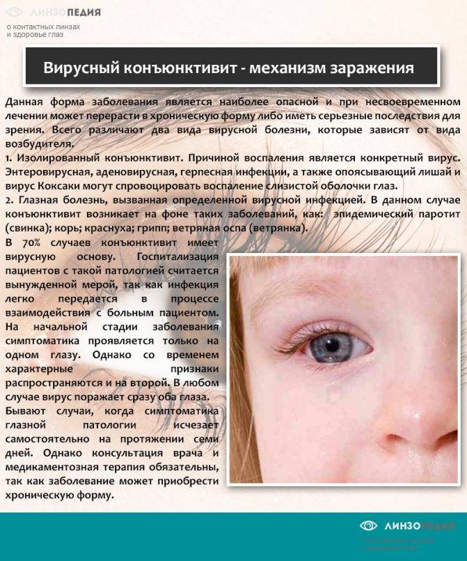 Острый конъюнктивит: симптомы и лечение - "здоровое око"