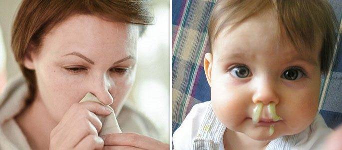 У ребёнка насморк и слезятся глазки: основные причины и способы лечения