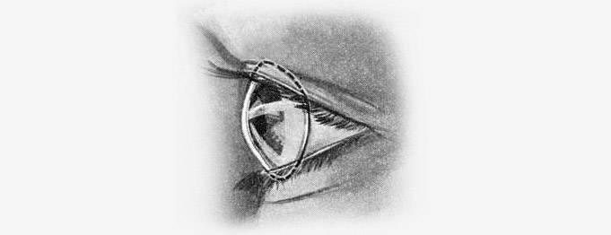 Как были придуманы контактные линзы?. кто есть кто в мире открытий и изобретений