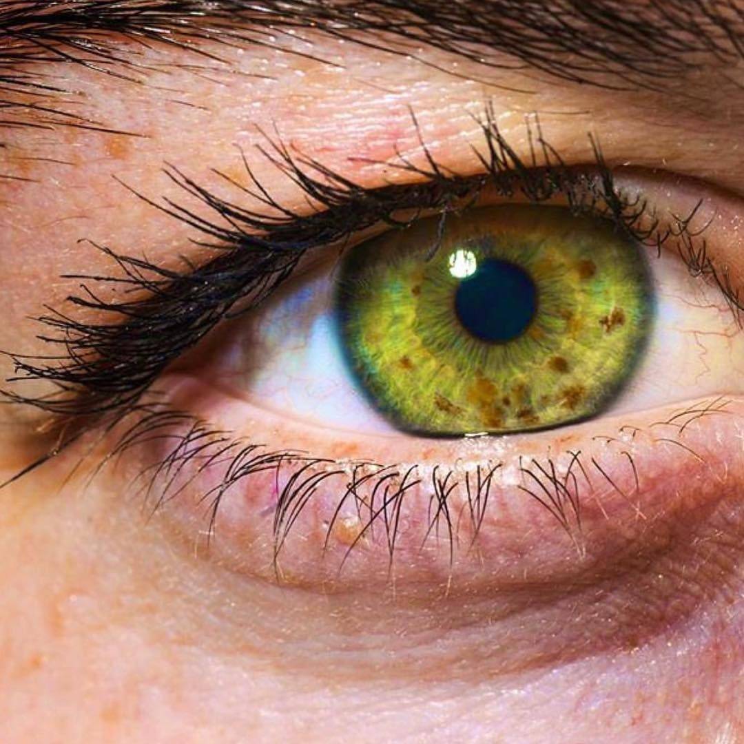 Что такое гетерохромия глаз? почему глаза у людей разного цвета: причины