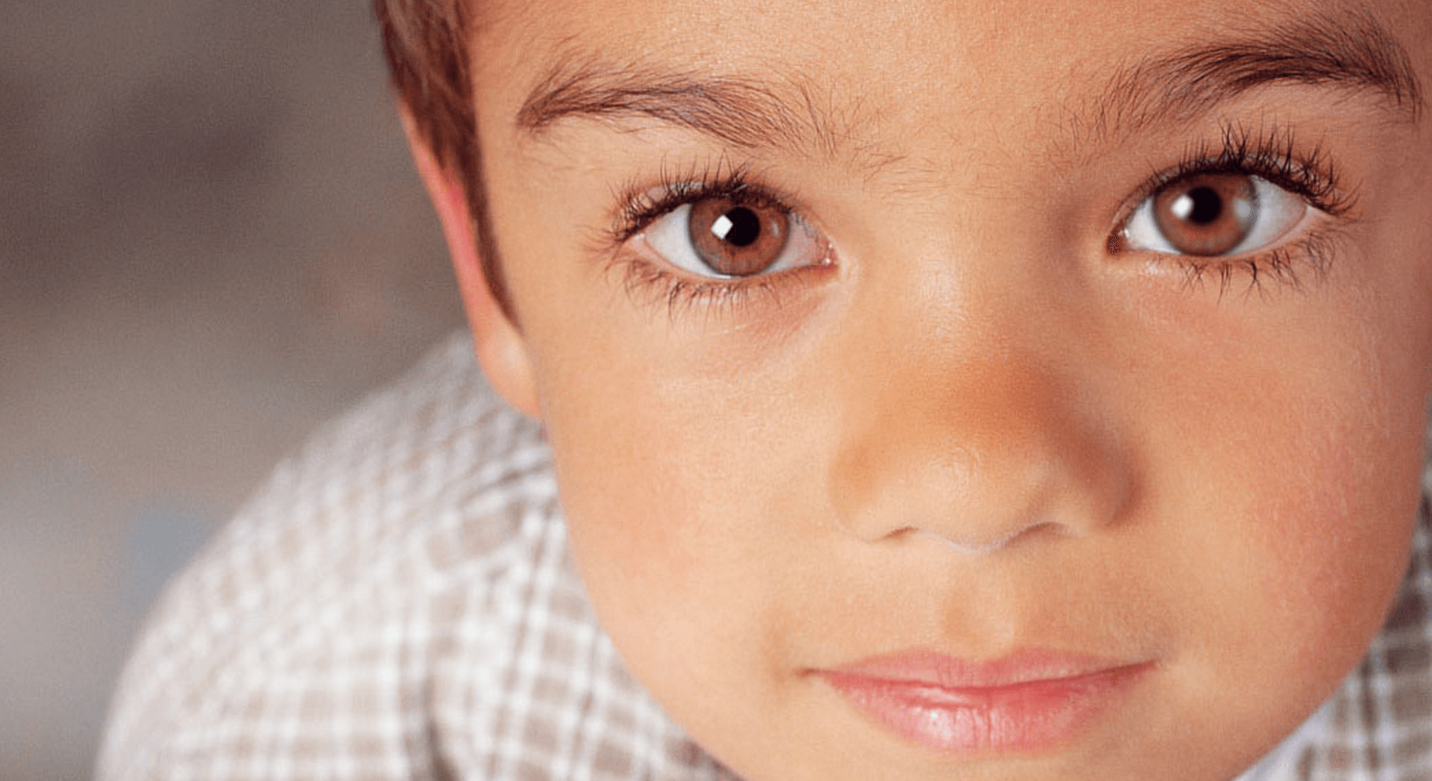 Рефракционная амблиопия у детей и взрослых - чем характеризуется синдром ленивого глаза, степени, симптомы и лечение нарушения