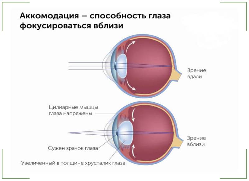 Спазм аккомодации: капли для глаз, расслабляющие мышцы