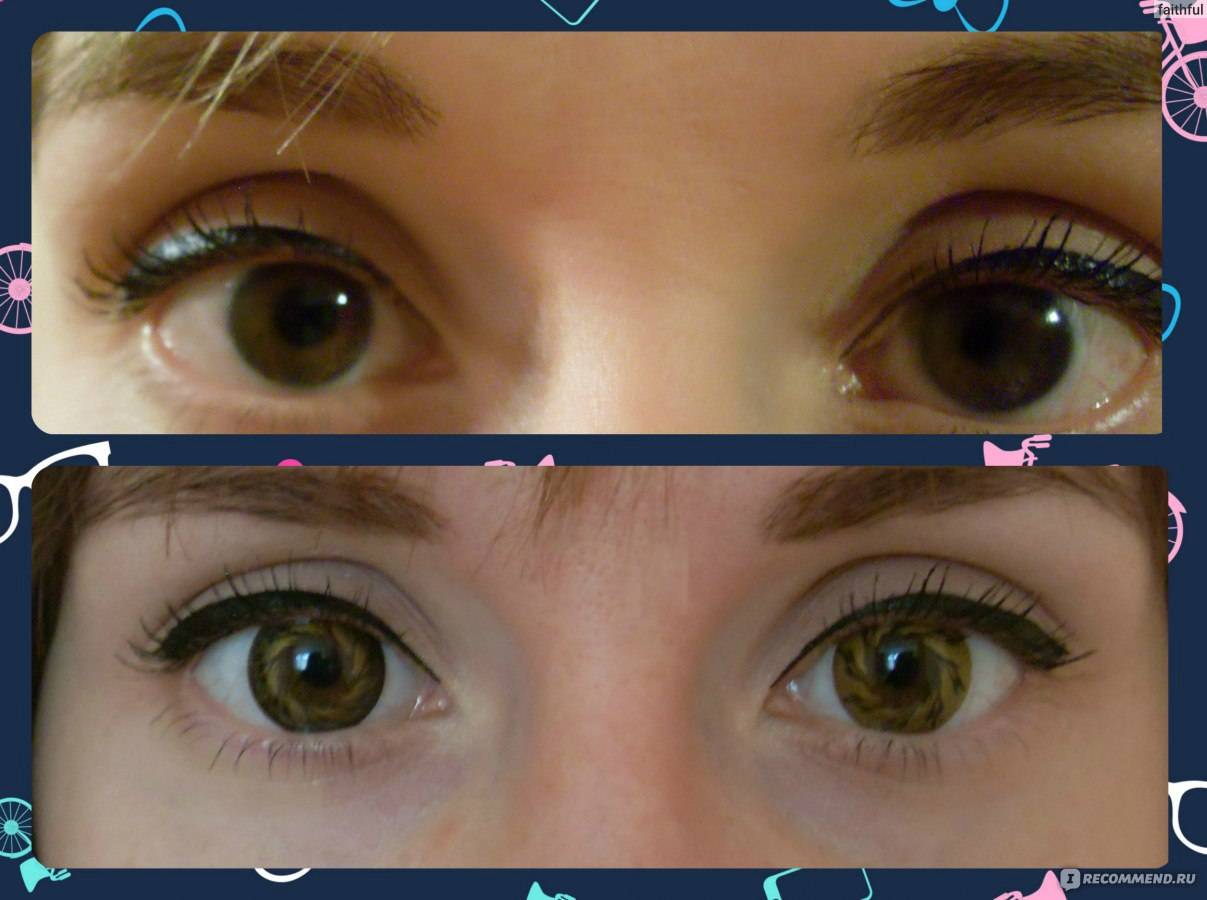 Как подобрать линзы для глаз без врача