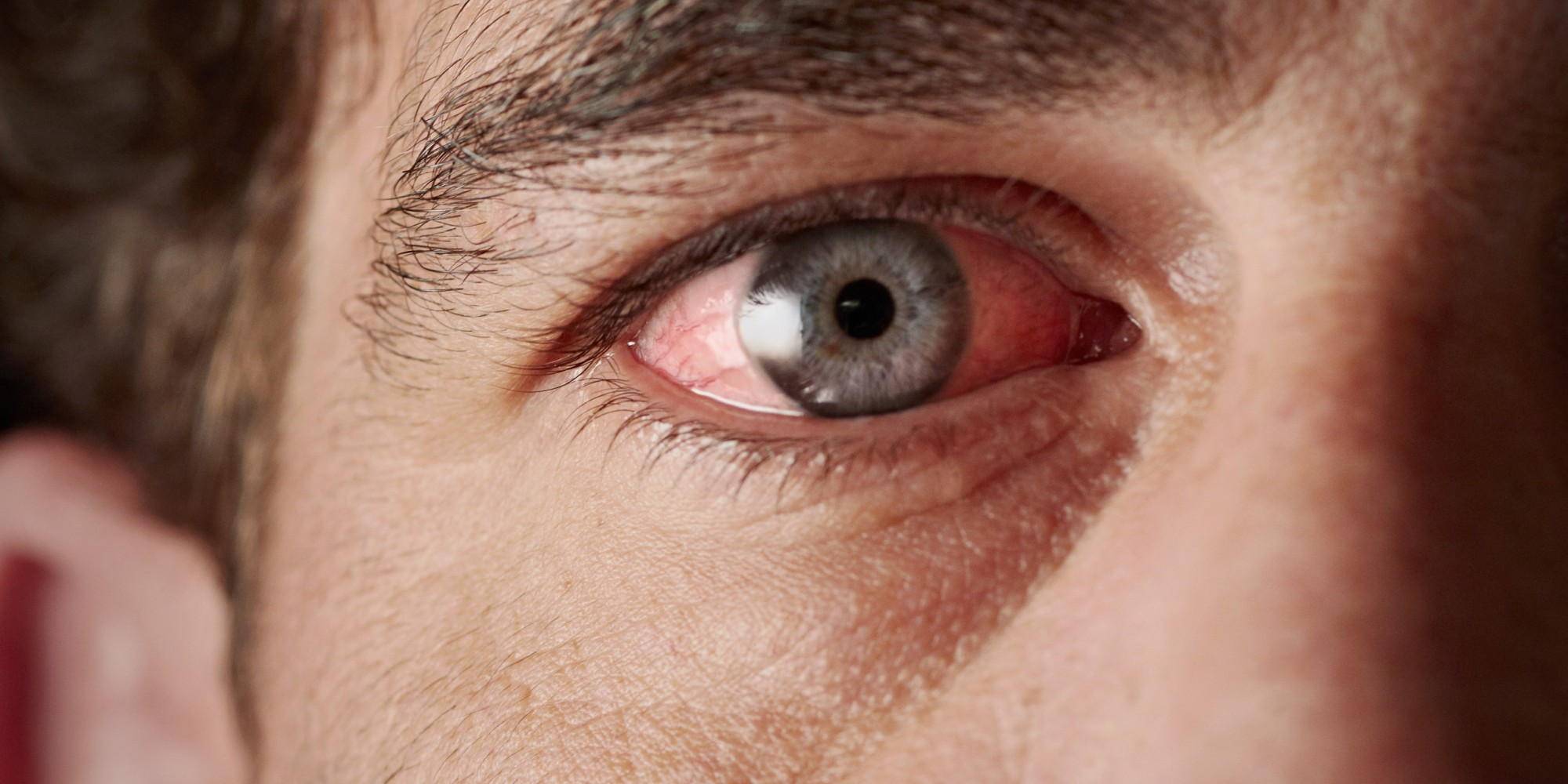 Причины и лечение слезоточивости: почему слезятся глаза на улице