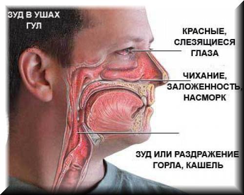 У ребёнка слезятся глаза и насморк: причины и лечение oculistic.ru
у ребёнка слезятся глаза и насморк: причины и лечение
