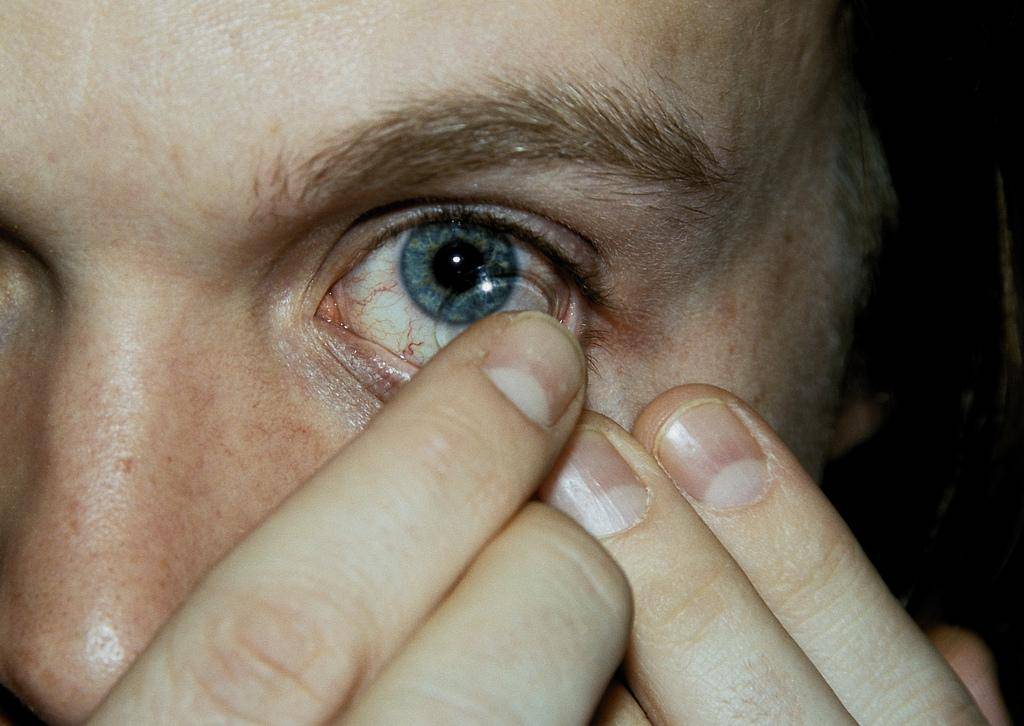 Болят глаза после линз: почему вы стали это ощущать, когда надеваете контактные корректоры, а также при ношении и снятии цветных, и что делать для устранения причин?