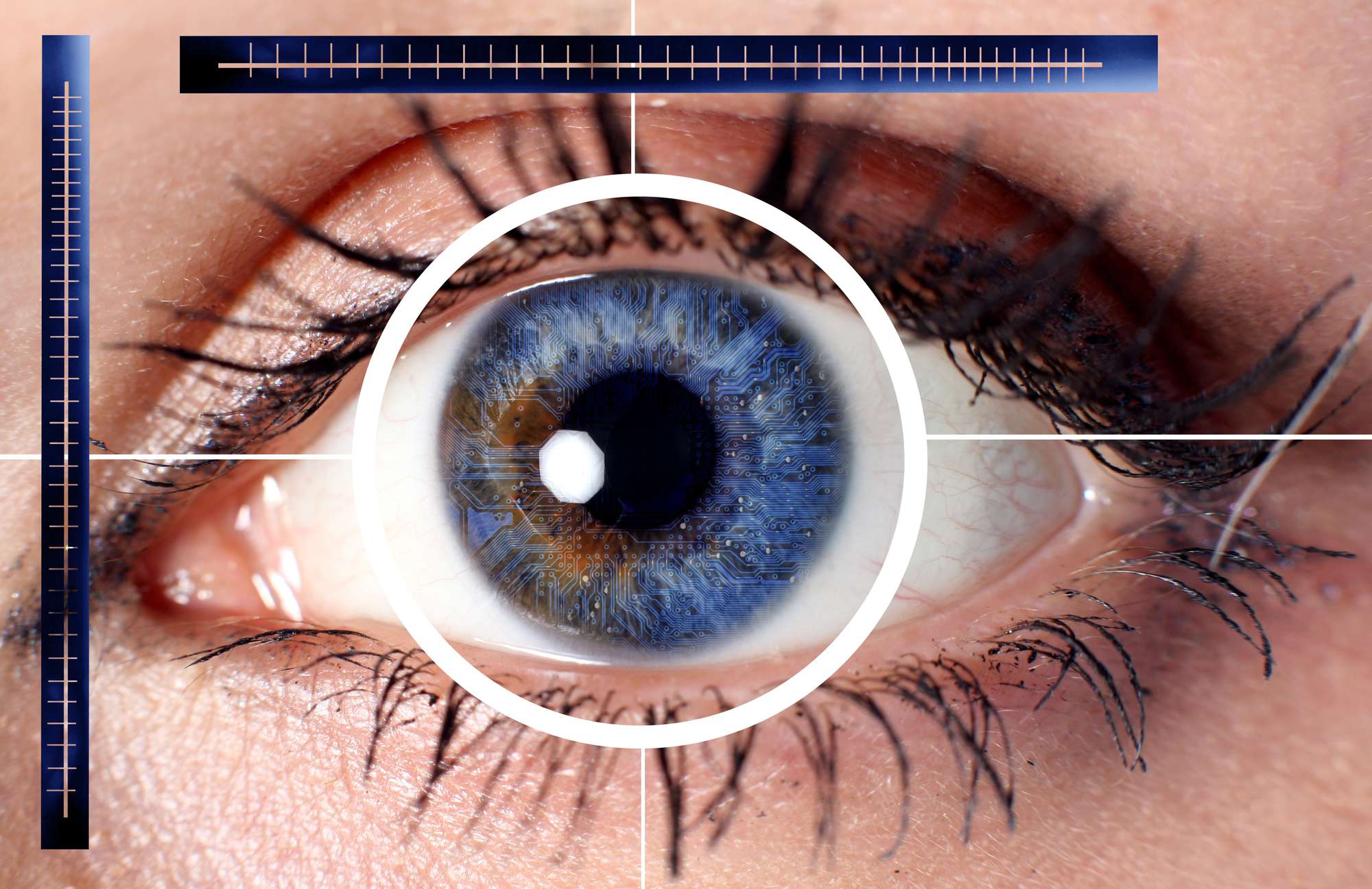 Операция по смене цвета глаз: лазерное изменение, другие виды коррекции