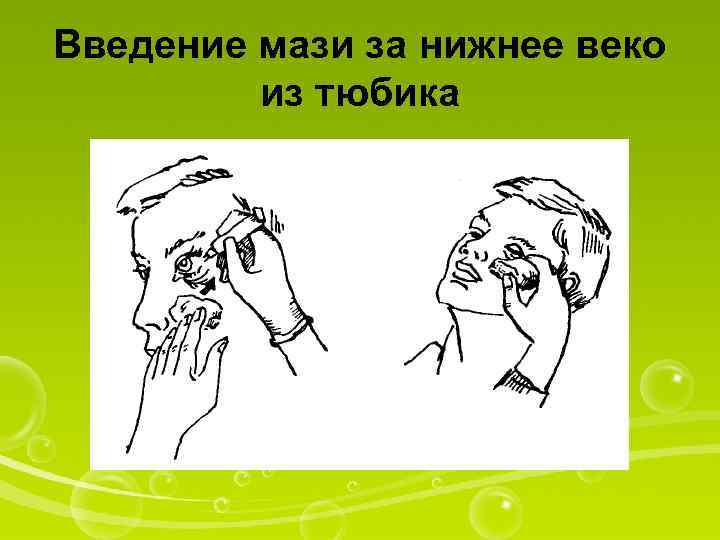 Алгоритм закладывания мази в глаза новорожденному - wikimed+24.ru