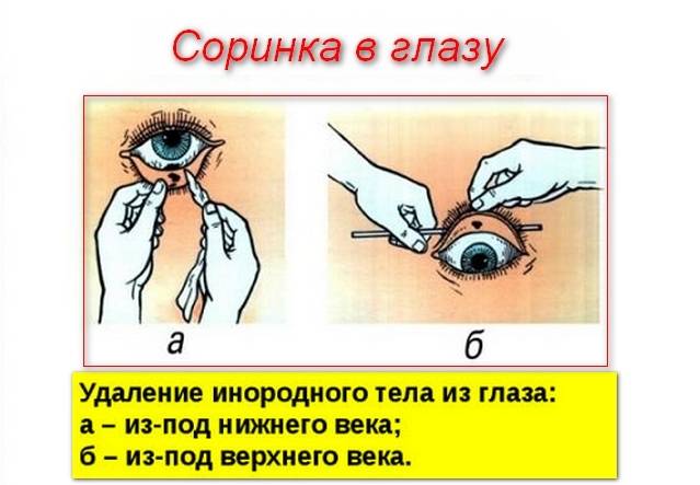 Что делать, если ткнули в глаз пальцем? - онлайн медик