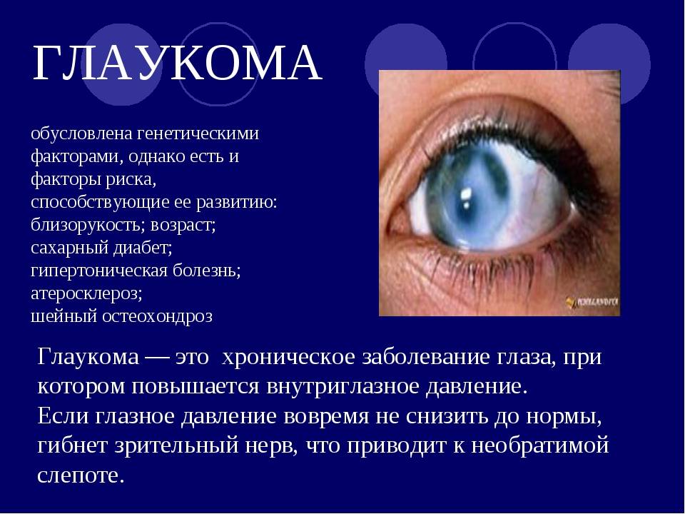Глаукома, симптомы, профилактика, лечение глаукомы.
