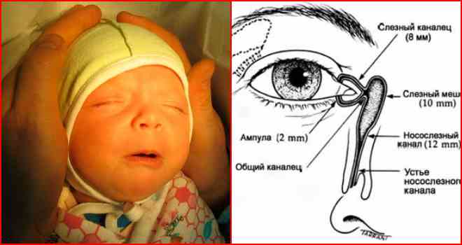 Как делать массаж слёзного канала у новорождённых oculistic.ru
как делать массаж слёзного канала у новорождённых
