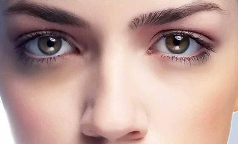 Почему вокруг глаз темные круги у женщин. как лечить черные круги под глазами