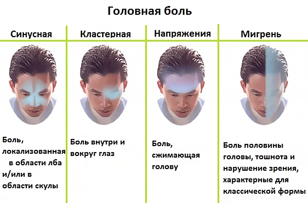 Болит макушка головы сверху по центру: симптомы, причины возникновения, лечение, профилактика