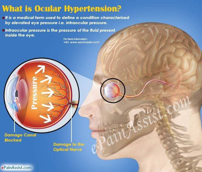 Что такое глазная гипертензия