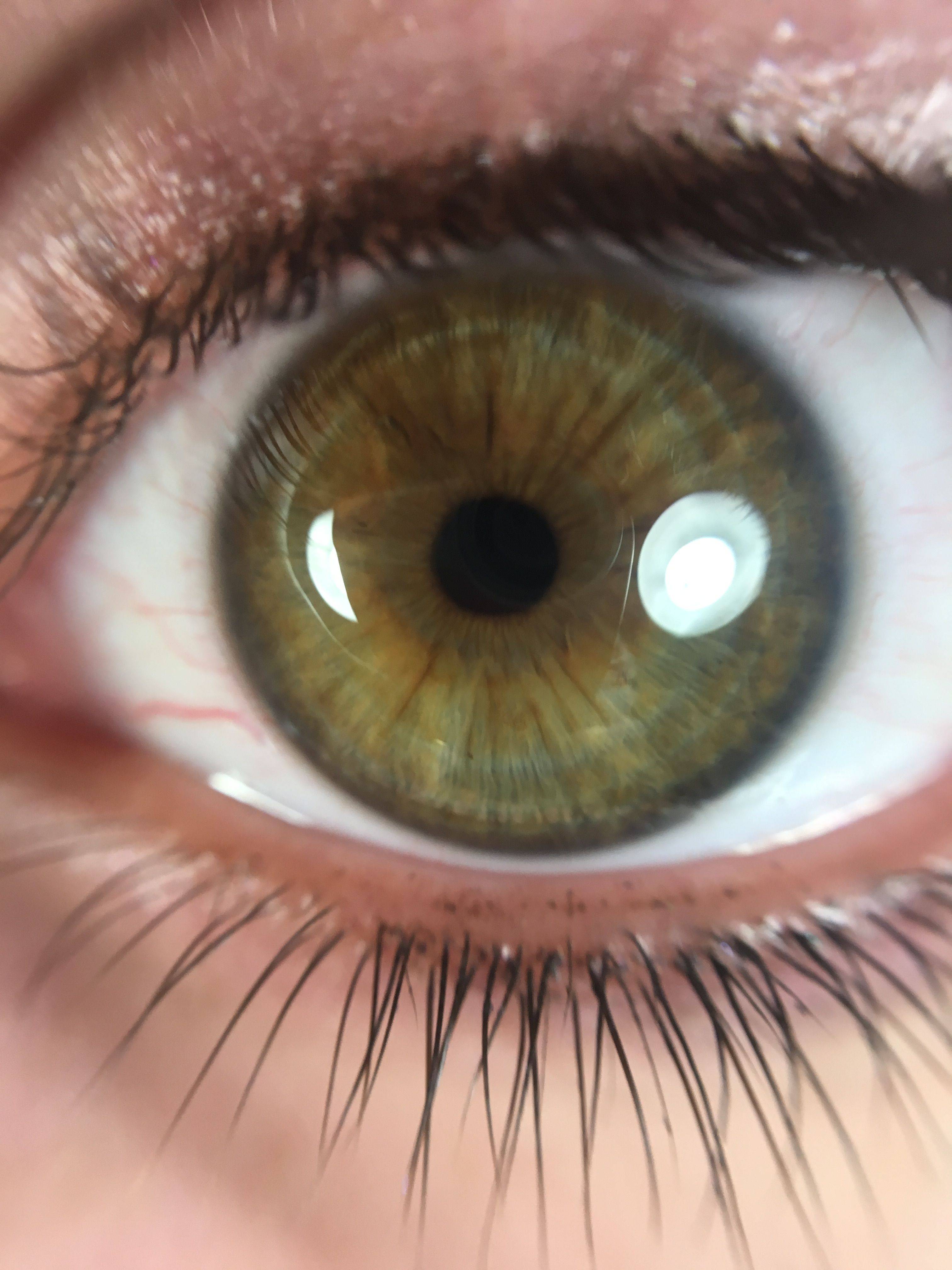 Карие глаза становятся зелеными. меняется ли цвет глаз у новорожденных и во сколько? тип характера и значение смены цвета глаз у людей.