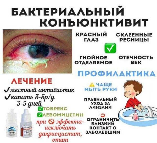 Детские глазные капли от конъюнктивита