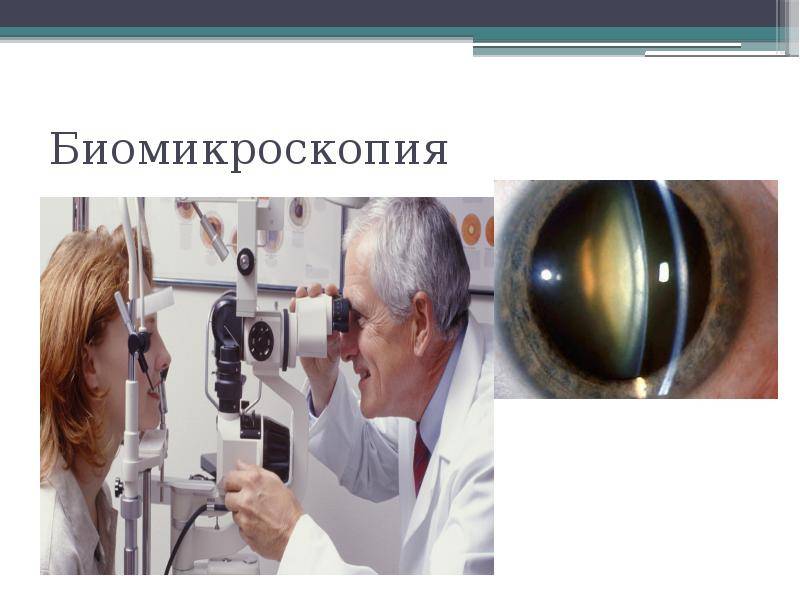 Биомикроскопия глаза что это показания как проводят