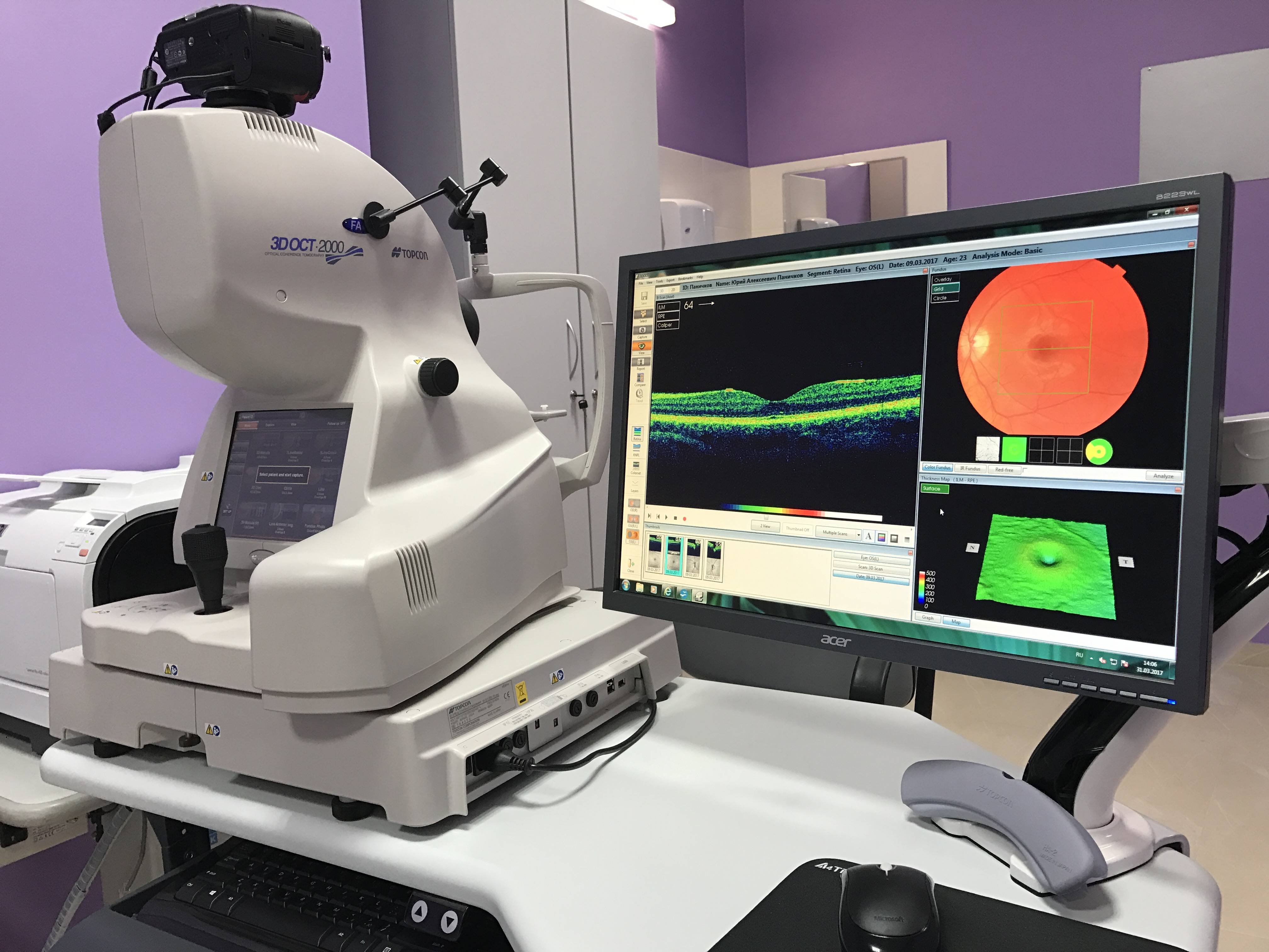 Окт - оптическая когерентная томография глаз (сетчатки, зрительного нерва) - где сделать, стоимость в клиниках