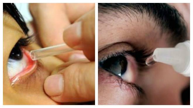 Как промыть глаз от соринки: проверенные способы и препараты