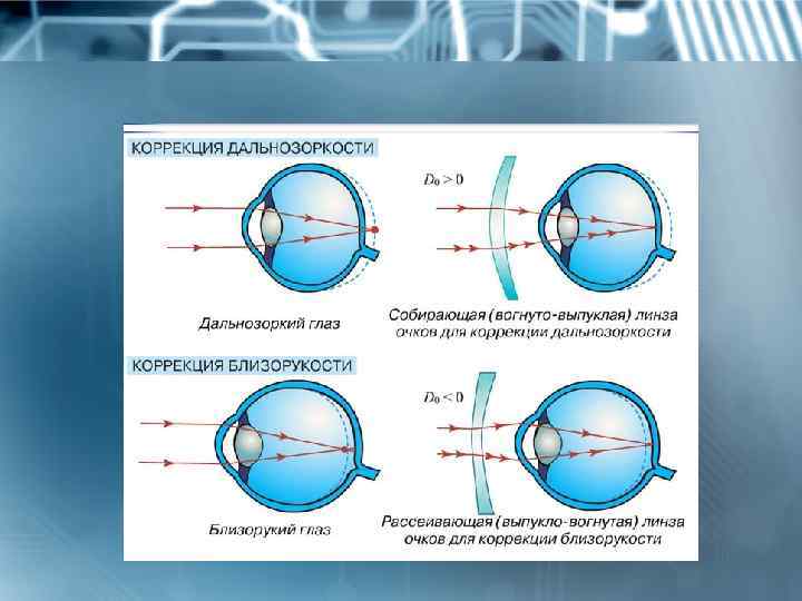 Очки для дальнозоркости приносят дискомфорт? выход есть — контактные линзы