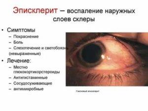Аметропия  что это за заболевание. что нужно знать о аметропии глаза — офтальмология