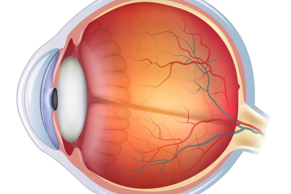 Сетчатка глаза — болезни и лечение