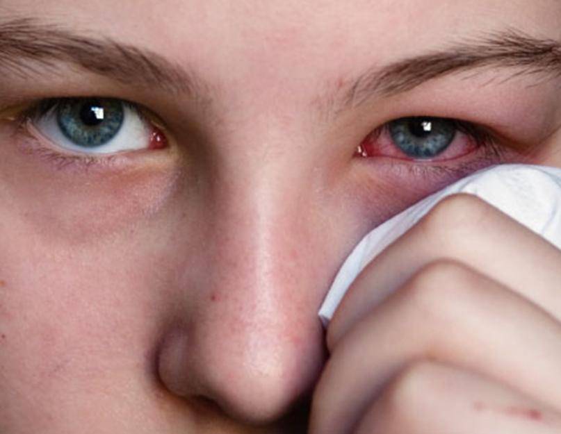 Почему болят глаза – 7 наиболее распространенных причин