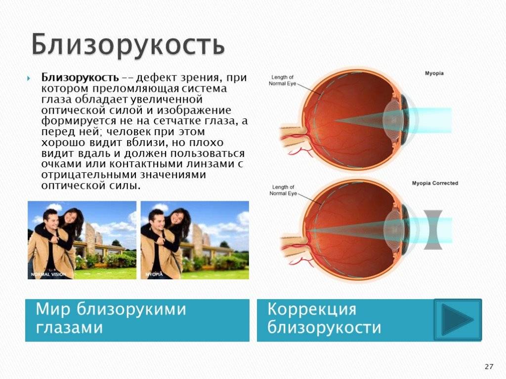 Монокулярное зрение и его отличия от бинокулярного