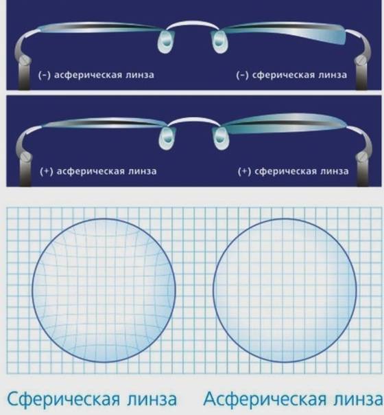 Асферические линзы (для очков и контактные): обзор, описание, преимущества и недостатки