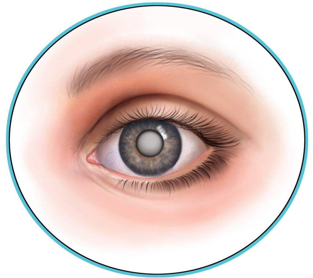 Расплывается в глазах: причины ухудшения зрения