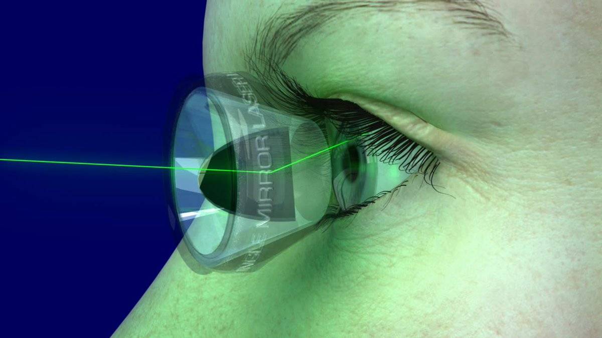 Лазерная стимуляция глаз