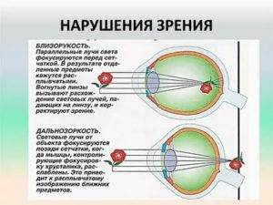 Нарушения зрения - люди с дефектами, виды проблем, классификация