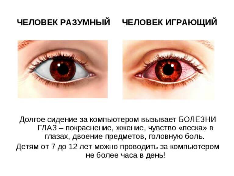 Красные глаза после сна: причины, симптоматика и методы лечения - "здоровое око"