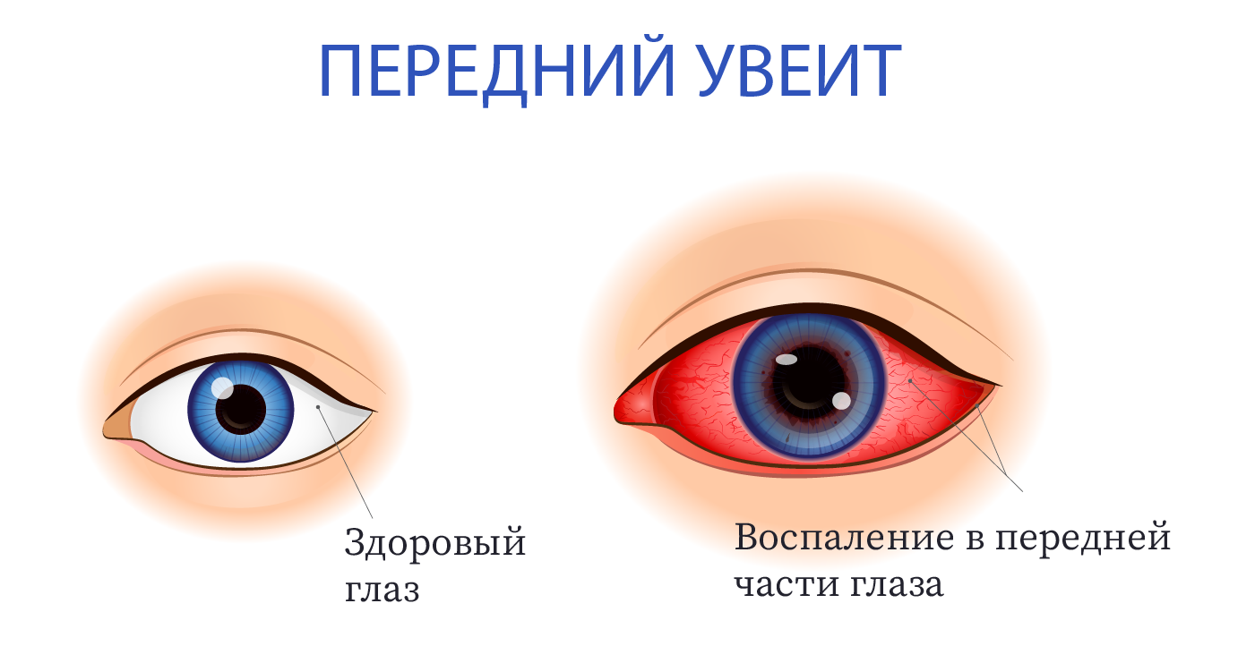 Ирит Это