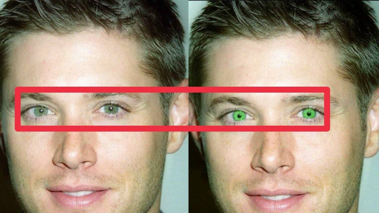 Поможет ли изменить цвет глаз операция или лучше выбрать другой метод?