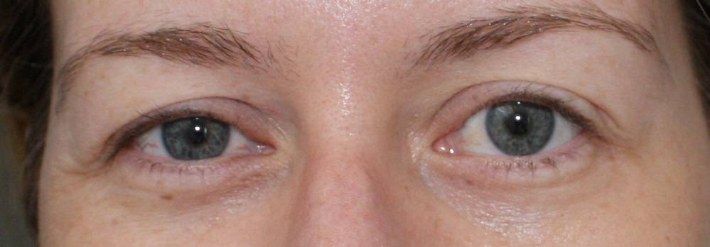 10 опасных глазных симптомов, все о глазах на портале vseozrenii.