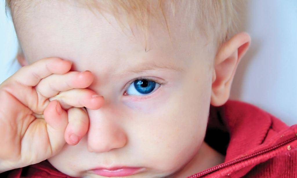 Ребенок трет глаза – причины, что делать