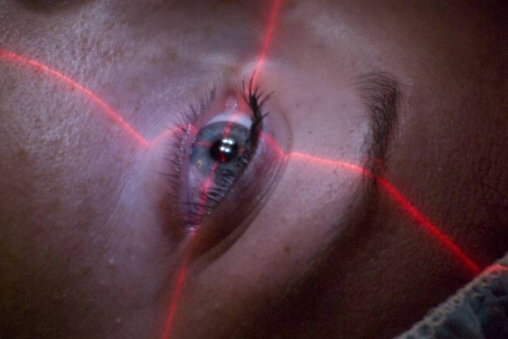 Лазерная коррекция: можно ли вернуть идеальное зрение раз и навсегда — wonderzine