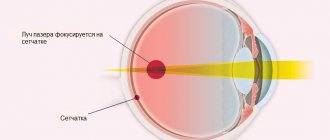 Гемофтальм глаза: лечение, причины, классификация, симптомы