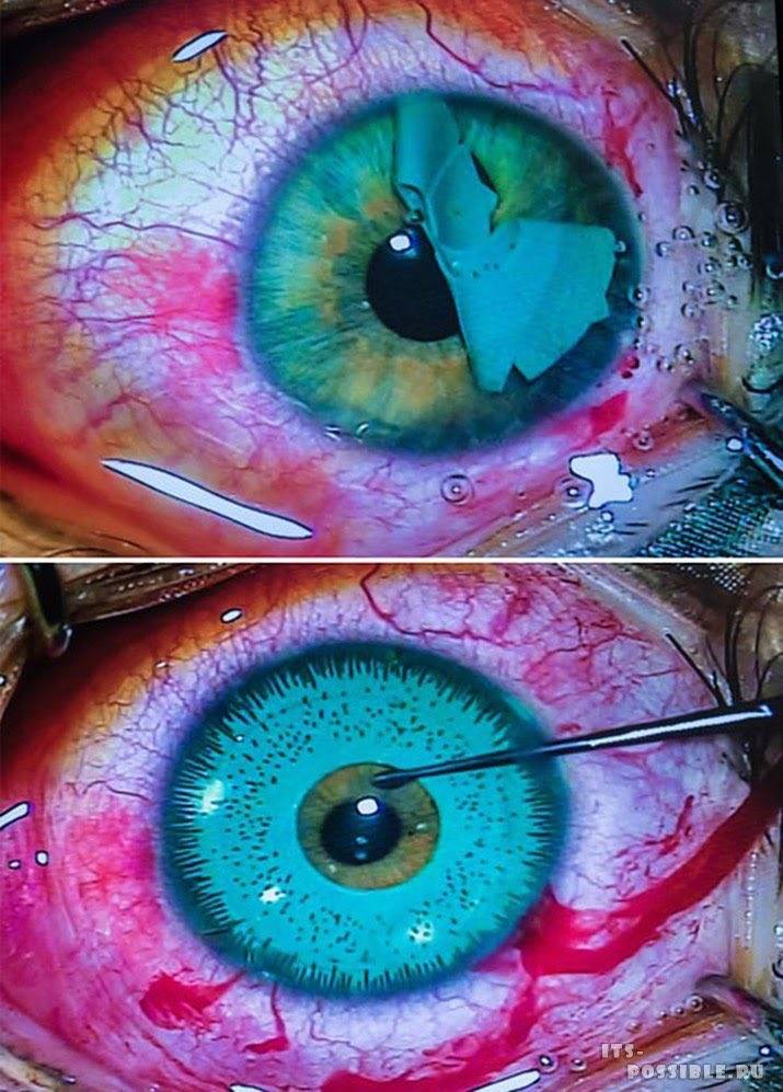Как изменить цвет глаз: без линз, в домашних условиях, операция, глаза-хамелеоны