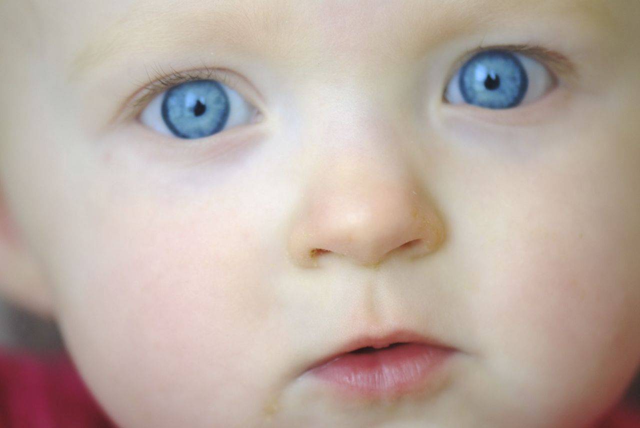 Почему у ребенка могут появляться темные круги под глазами?