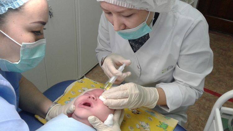 Промывание слезного канала у новорожденного - "здоровое око"