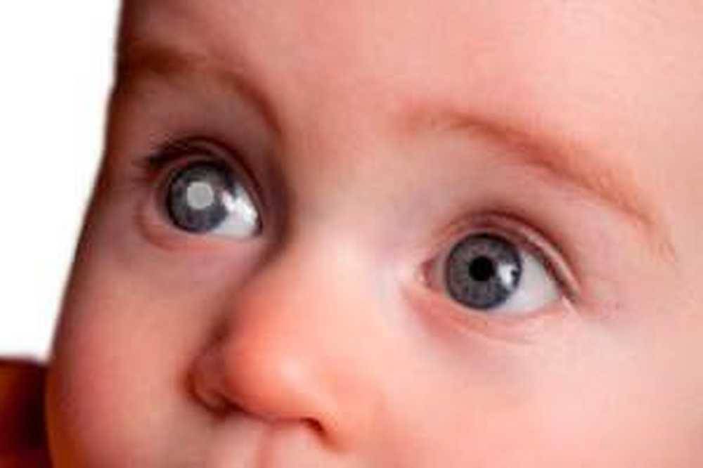 Врожденная катаракта у детей, причины и операция точечной катаракты у новорожденных