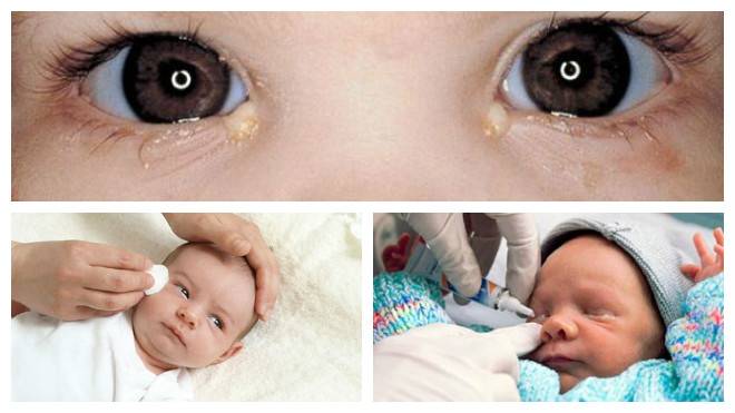 Причины покраснения глаз у грудничков и новорожденных детей